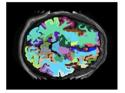 AI e ricerca biomedica 2
